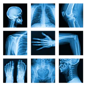 Appel à la grève des radiologues - Dr Henri Guerini - Communiqué de Presse du 4 déc. 2025